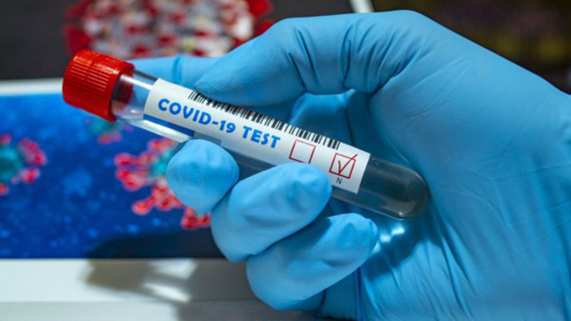 COVID-19 test